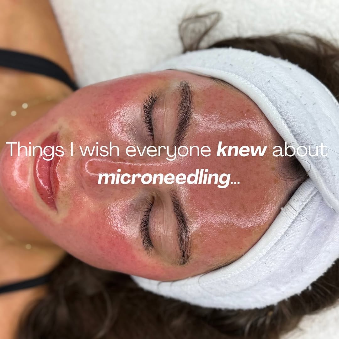Post 9 by | SKIN TRAINING ACADEMY | MEDICAL GRADE FACIALS | on Instagram (carousel)