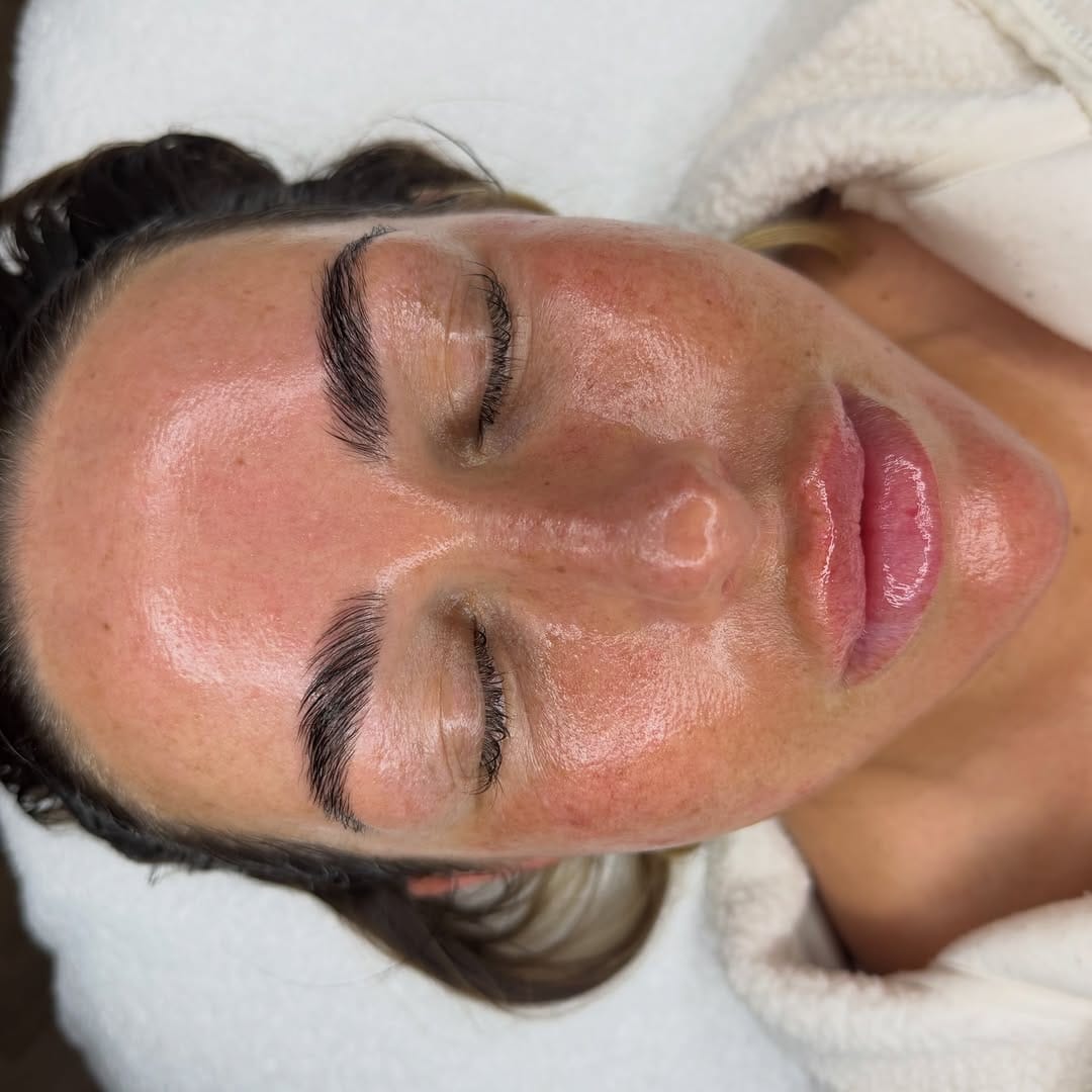 Post 4 by | SKIN TRAINING ACADEMY | MEDICAL GRADE FACIALS | on Instagram (carousel)