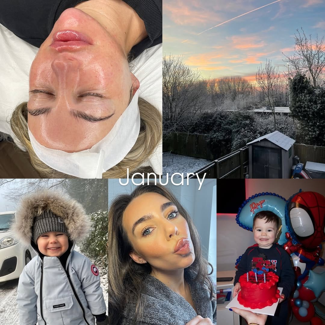 Post 7 by | SKIN TRAINING ACADEMY | MEDICAL GRADE FACIALS | on Instagram (carousel)
