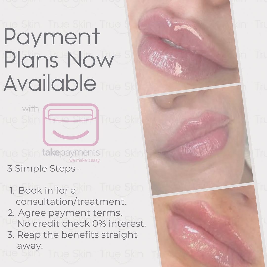 Post 10 by TrueSkin - Lip Fillers & Smooth Skin on Instagram (carousel)