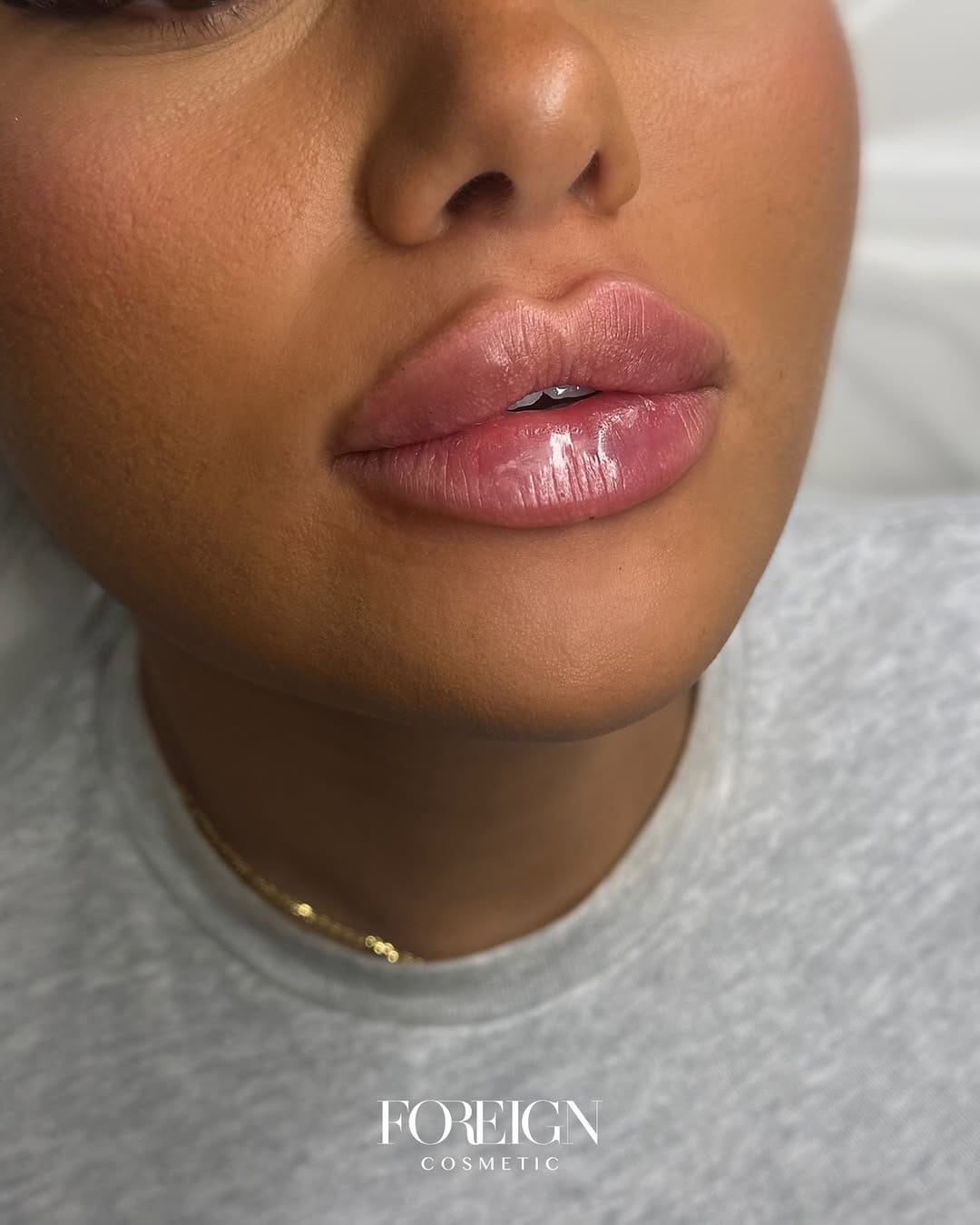 Post 1 by Sabrina Di Pietrantonio | Aesthetics & Training Academy on Instagram (carousel)