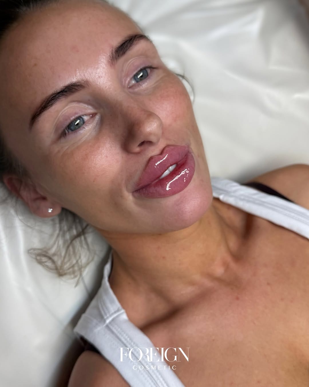 Post 5 by Sabrina Di Pietrantonio | Aesthetics & Training Academy on Instagram (carousel)