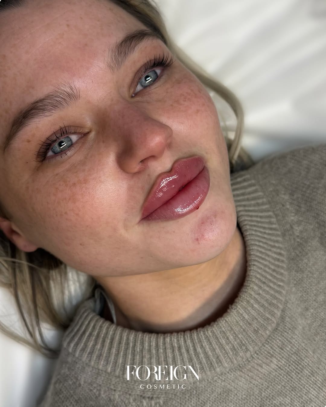 Post 2 by Sabrina Di Pietrantonio | Aesthetics & Training Academy on Instagram (carousel)