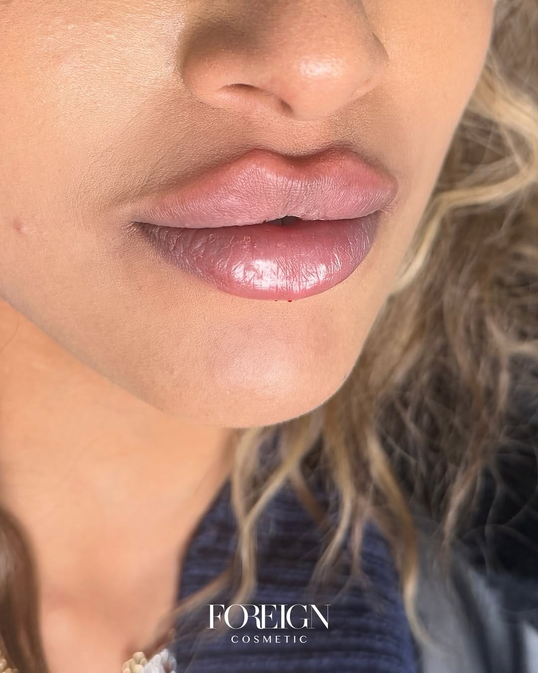 Post 4 by Sabrina Di Pietrantonio | Aesthetics & Training Academy on Instagram (carousel)