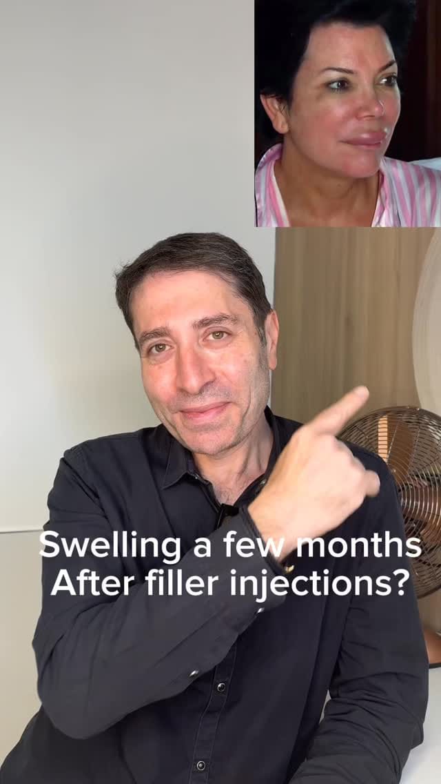Post 10 by Dr Pejman Safaie on Instagram (video)