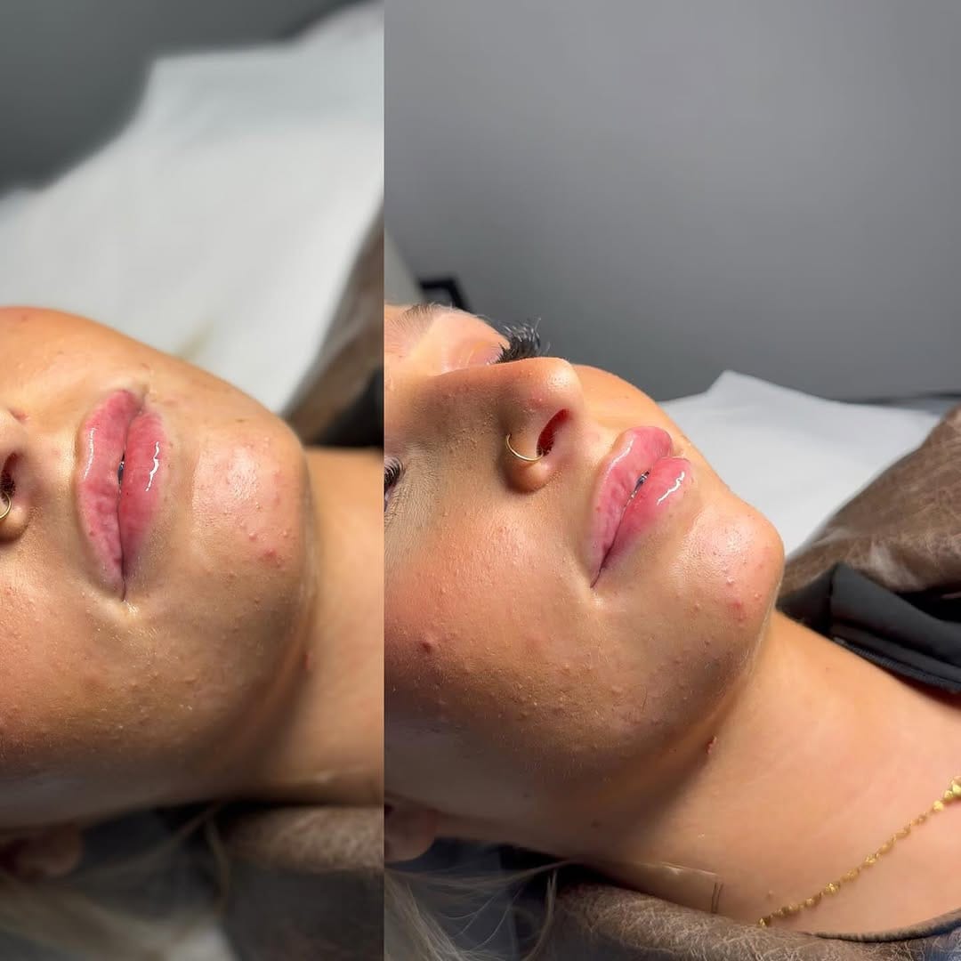 Post 4 by OLIVIA ALICE - SKIN | LASH | AESTHETICS & BROWS - NOTTINGHAM on Instagram (image)