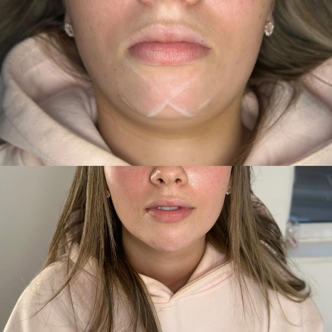 Post 2 by OLIVIA ALICE - SKIN | LASH | AESTHETICS & BROWS - NOTTINGHAM on Instagram (image)
