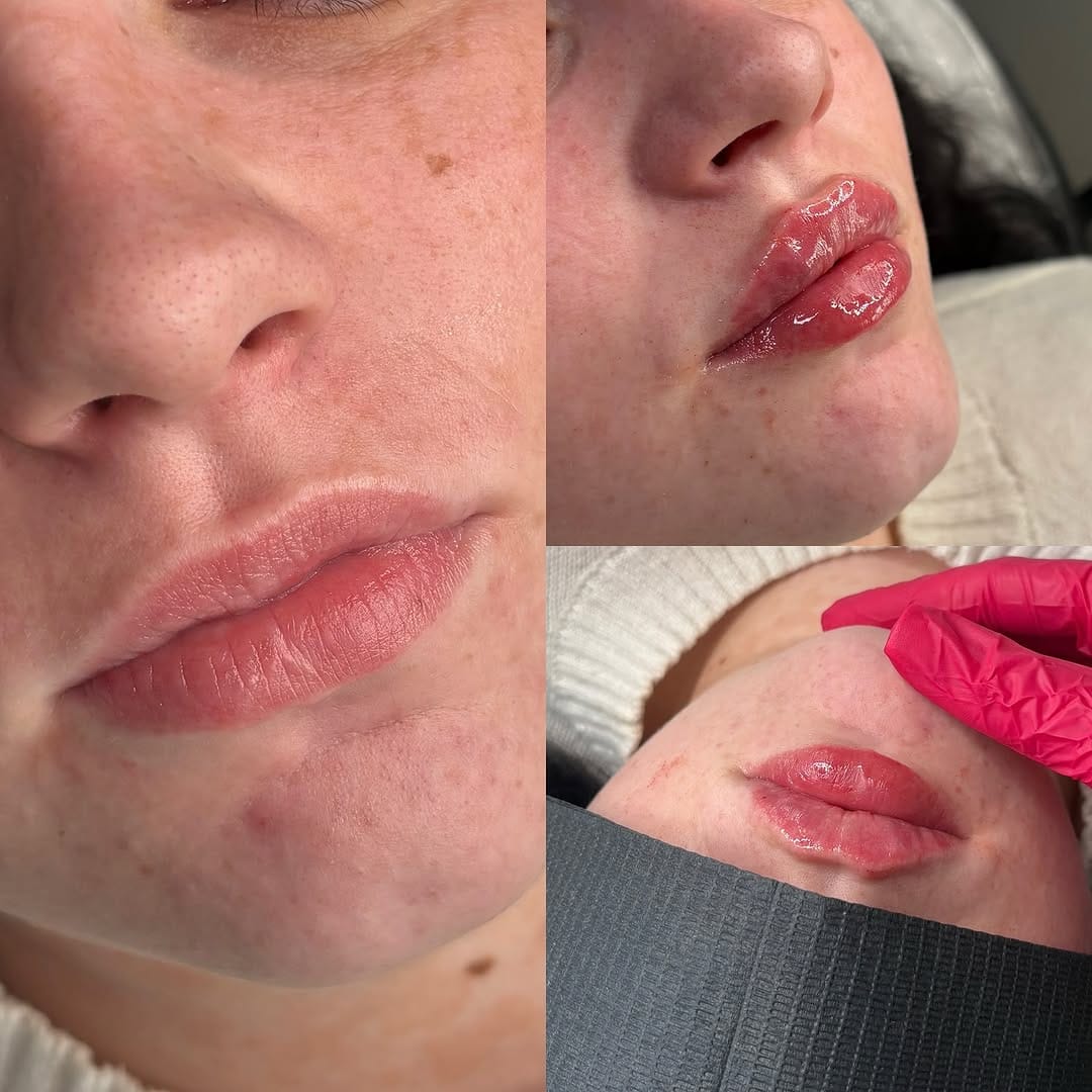 Post 9 by OLIVIA ALICE - SKIN | LASH | AESTHETICS & BROWS - NOTTINGHAM on Instagram (image)