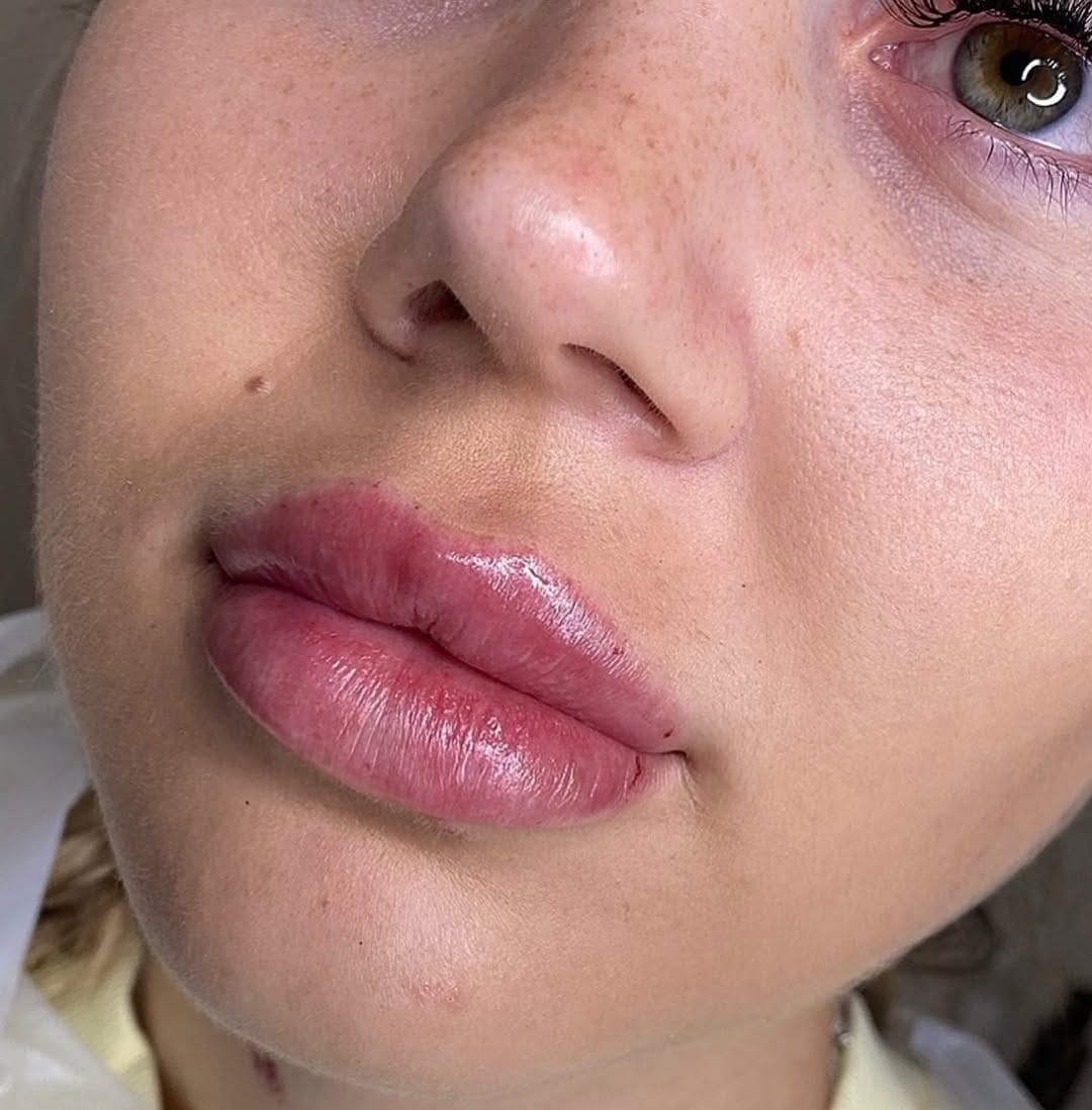 Post 7 by Award Winning Skin Expert on Instagram (image)