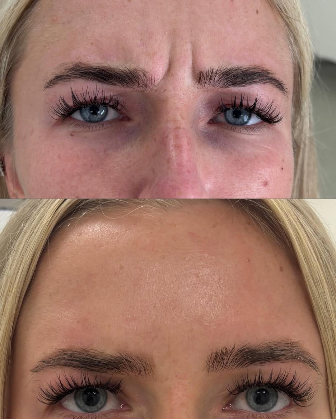 Post 6 by AMY SENGUL | AESTHETICS | FACIALS | EDINBURGH | BROWS + LASHES on Instagram (carousel)