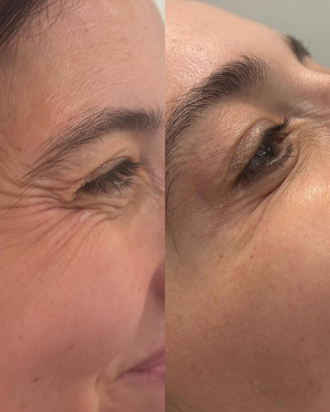 Post 5 by AMY SENGUL | AESTHETICS | FACIALS | EDINBURGH | BROWS + LASHES on Instagram (carousel)