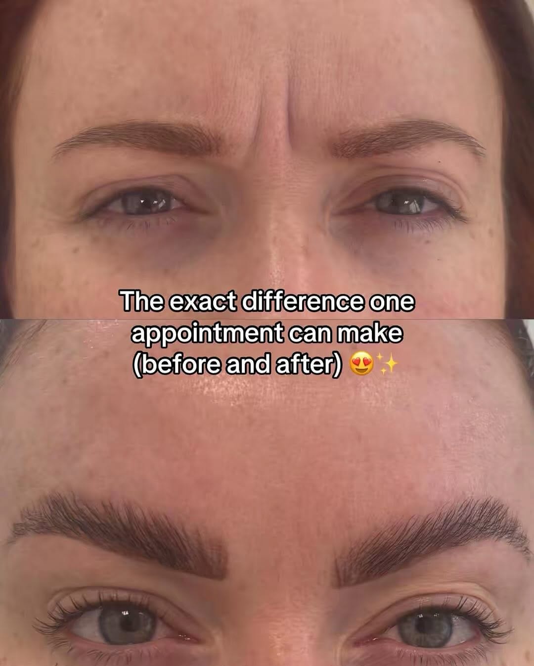 Post 3 by AMY SENGUL | AESTHETICS | FACIALS | EDINBURGH | BROWS + LASHES on Instagram (carousel)