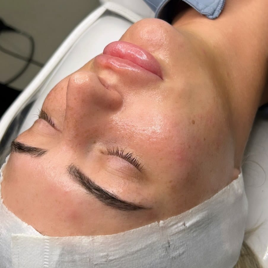 Post 9 by GLASS SKIN | FACIALS on Instagram (image)