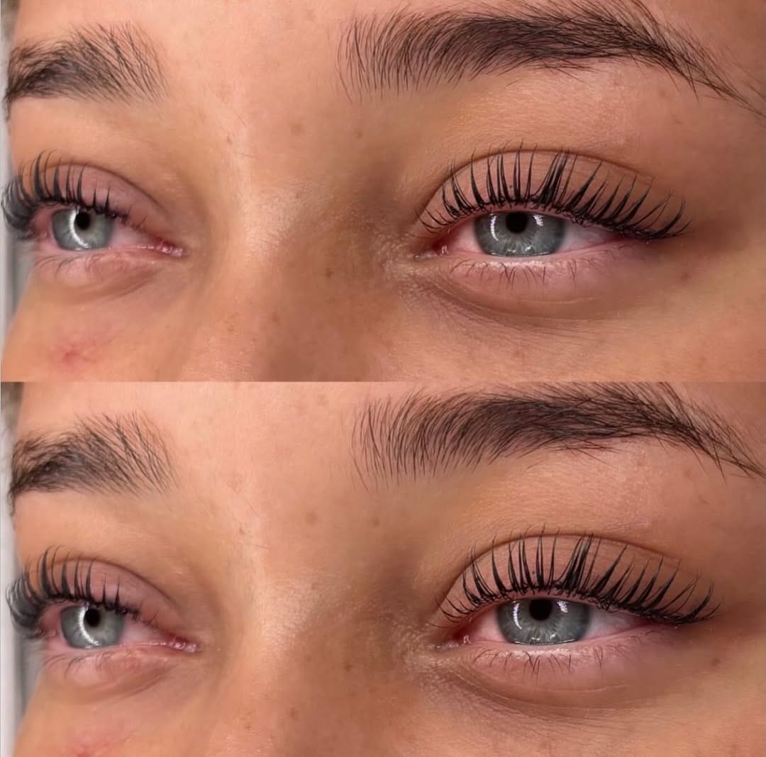 Post 8 by GLASS SKIN | FACIALS on Instagram (image)