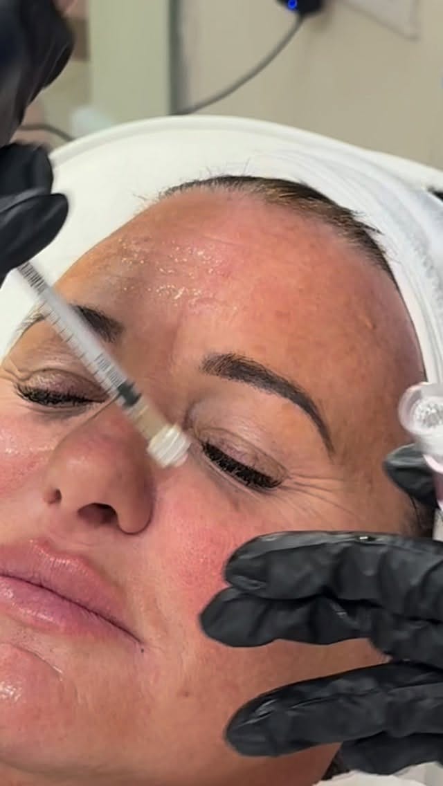 Post 10 by Beauty, Aesthetics & Online Training Manchester on Instagram (video)