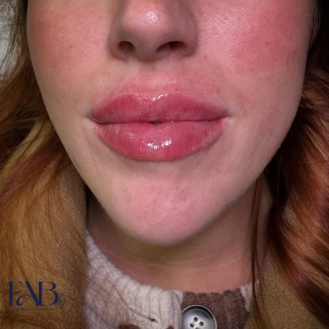 Post 8 by Beauty, Aesthetics & Online Training Manchester on Instagram (image)