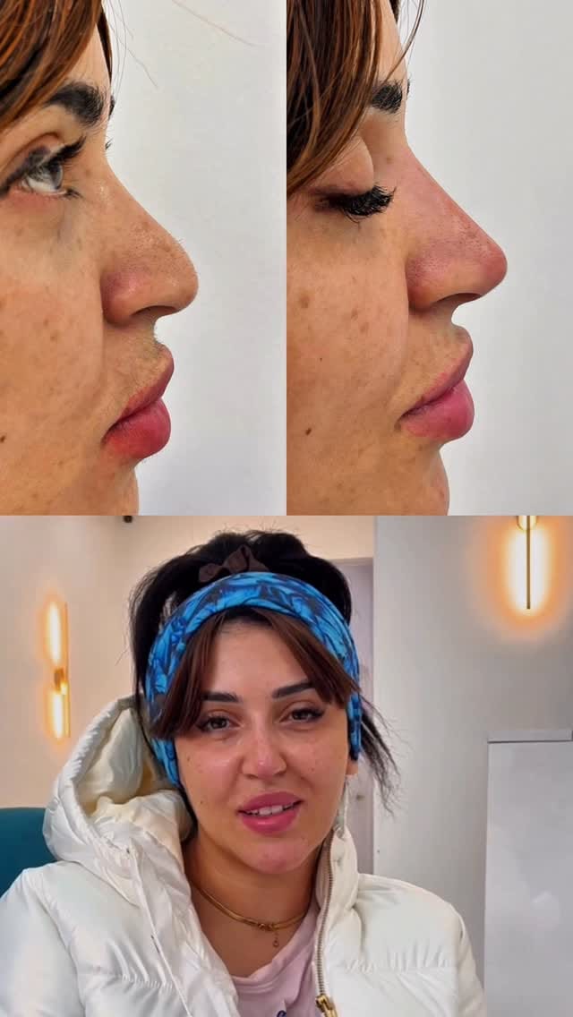 Post 4 by 𝗧𝗛𝗘 𝗖𝗟𝗜𝗡𝗜𝗖 𝗥𝗢𝗢𝗠® on Instagram (video)