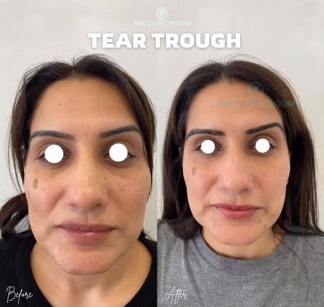 Post 2 by 𝗧𝗛𝗘 𝗖𝗟𝗜𝗡𝗜𝗖 𝗥𝗢𝗢𝗠® on Instagram (video)