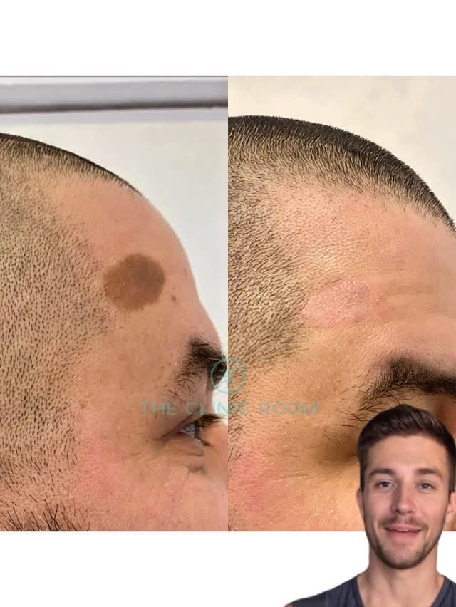Post 5 by 𝗧𝗛𝗘 𝗖𝗟𝗜𝗡𝗜𝗖 𝗥𝗢𝗢𝗠® on Instagram (video)