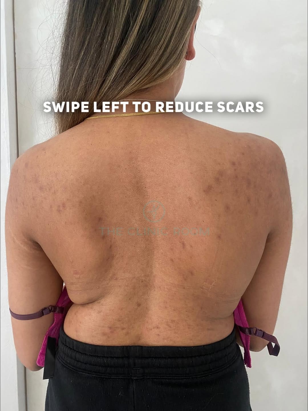 Post 1 by 𝗧𝗛𝗘 𝗖𝗟𝗜𝗡𝗜𝗖 𝗥𝗢𝗢𝗠® on Instagram (carousel)