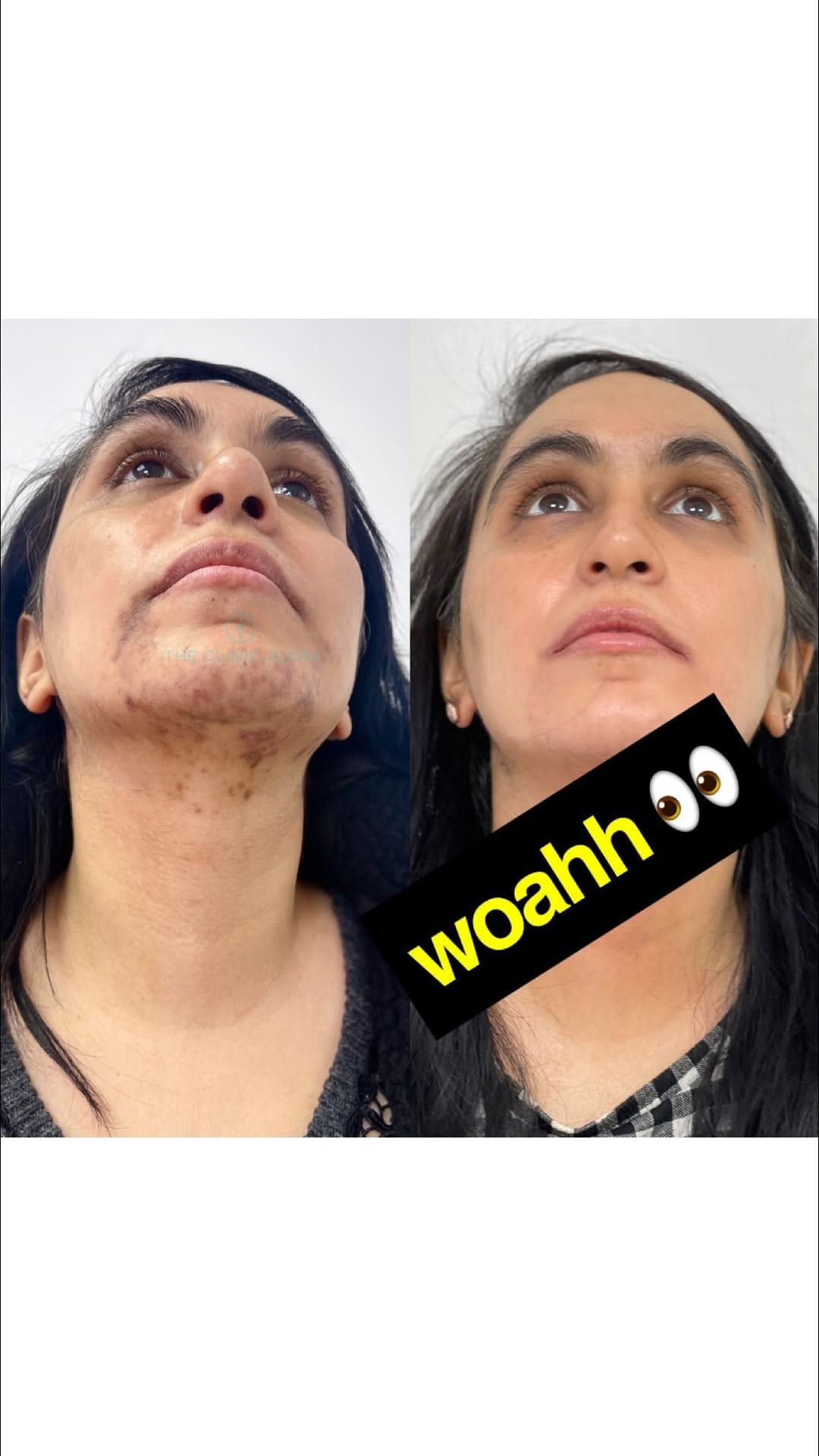Post 10 by 𝗧𝗛𝗘 𝗖𝗟𝗜𝗡𝗜𝗖 𝗥𝗢𝗢𝗠® on Instagram (video)