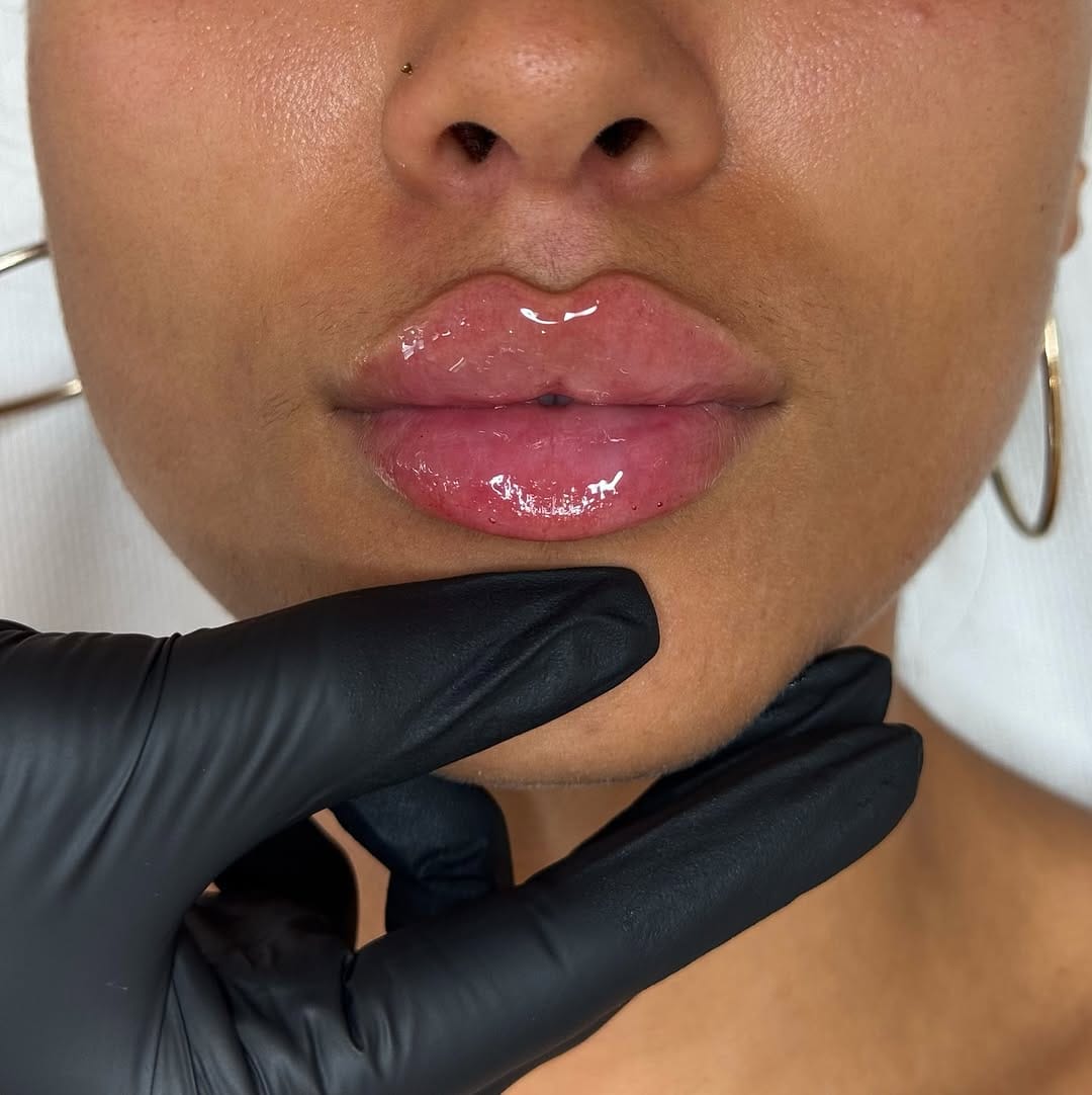 Post 10 by 𝐉𝐨𝐝𝐢𝐞 𝐏𝐚𝐫𝐬𝐨𝐧𝐬 l 𝐃𝐨𝐥𝐥𝐬𝐟𝐚𝐜𝐞 𝐀𝐞𝐬𝐭𝐡𝐞𝐭𝐢𝐜𝐬 ® l 𝐂𝐥𝐢𝐧𝐢𝐜 & 𝐀𝐜𝐚𝐝𝐞𝐦𝐲 on Instagram (carousel)