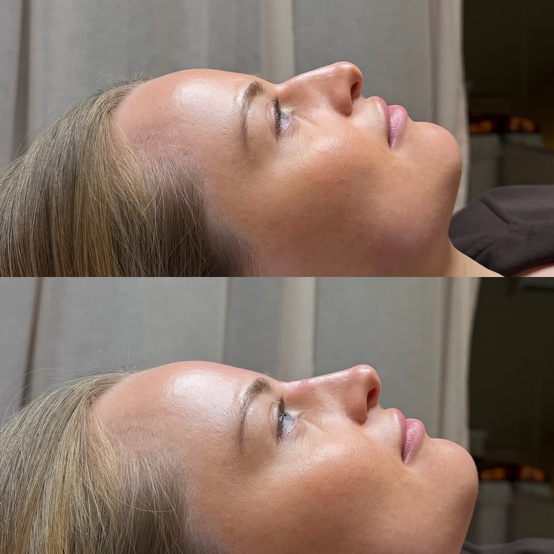 Post 2 by 𝐉𝐨𝐝𝐢𝐞 𝐏𝐚𝐫𝐬𝐨𝐧𝐬 l 𝐃𝐨𝐥𝐥𝐬𝐟𝐚𝐜𝐞 𝐀𝐞𝐬𝐭𝐡𝐞𝐭𝐢𝐜𝐬 ® l 𝐂𝐥𝐢𝐧𝐢𝐜 & 𝐀𝐜𝐚𝐝𝐞𝐦𝐲 on Instagram (image)