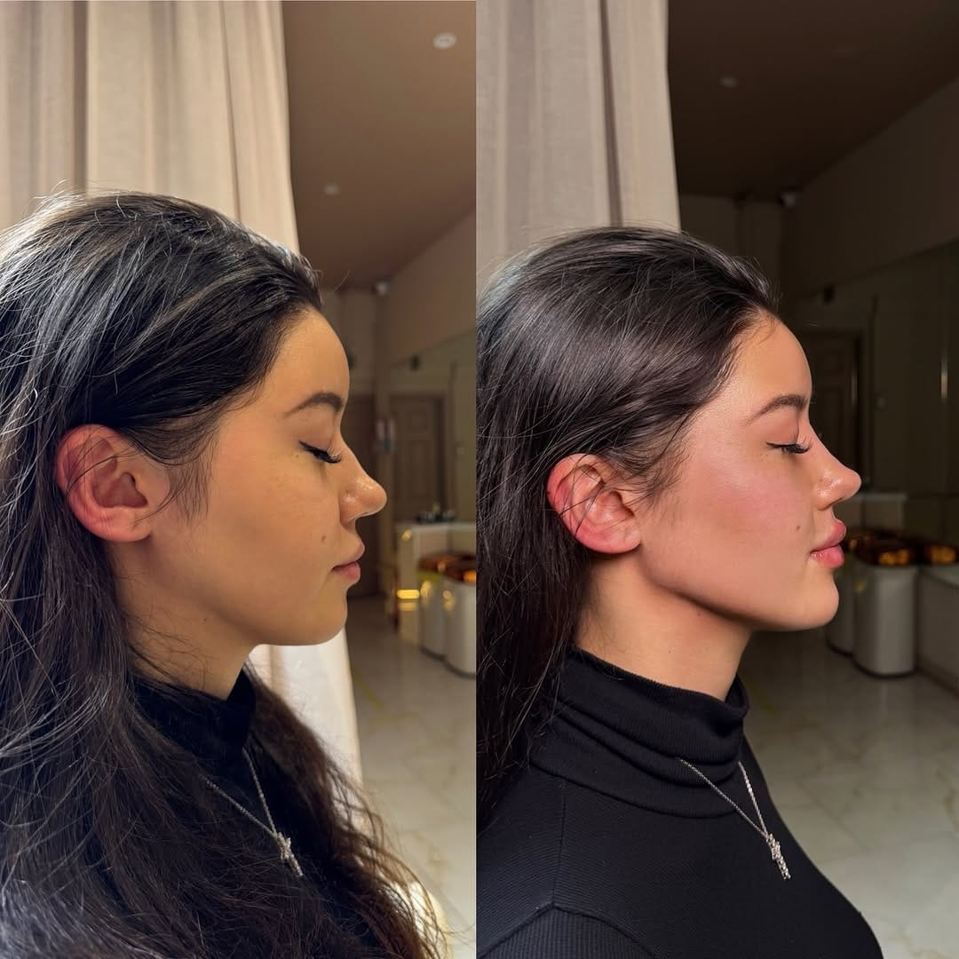 Post 6 by 𝐉𝐨𝐝𝐢𝐞 𝐏𝐚𝐫𝐬𝐨𝐧𝐬 l 𝐃𝐨𝐥𝐥𝐬𝐟𝐚𝐜𝐞 𝐀𝐞𝐬𝐭𝐡𝐞𝐭𝐢𝐜𝐬 ® l 𝐂𝐥𝐢𝐧𝐢𝐜 & 𝐀𝐜𝐚𝐝𝐞𝐦𝐲 on Instagram (carousel)