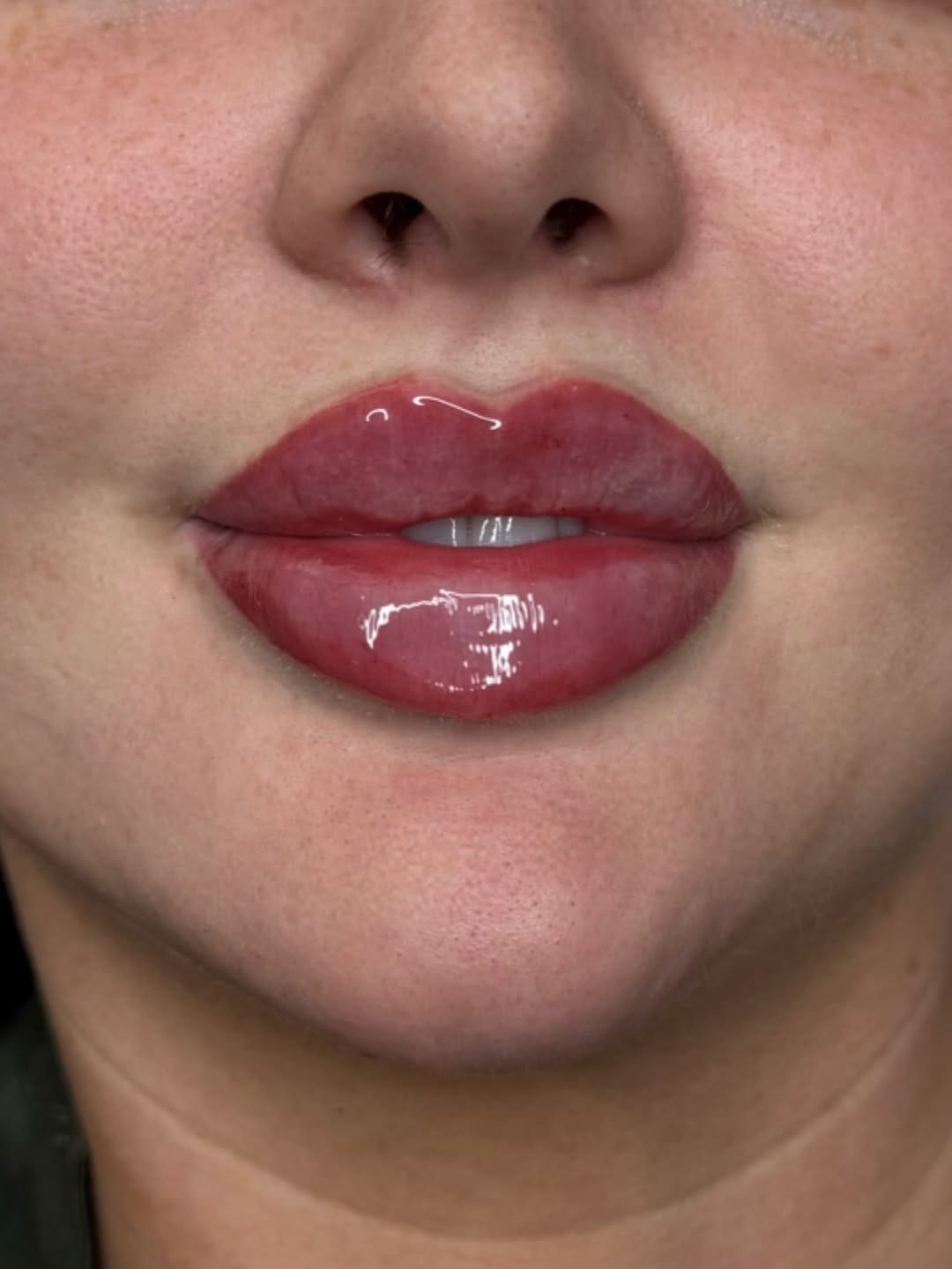 Post 4 by 𝐉𝐨𝐝𝐢𝐞 𝐏𝐚𝐫𝐬𝐨𝐧𝐬 l 𝐃𝐨𝐥𝐥𝐬𝐟𝐚𝐜𝐞 𝐀𝐞𝐬𝐭𝐡𝐞𝐭𝐢𝐜𝐬 ® l 𝐂𝐥𝐢𝐧𝐢𝐜 & 𝐀𝐜𝐚𝐝𝐞𝐦𝐲 on Instagram (image)