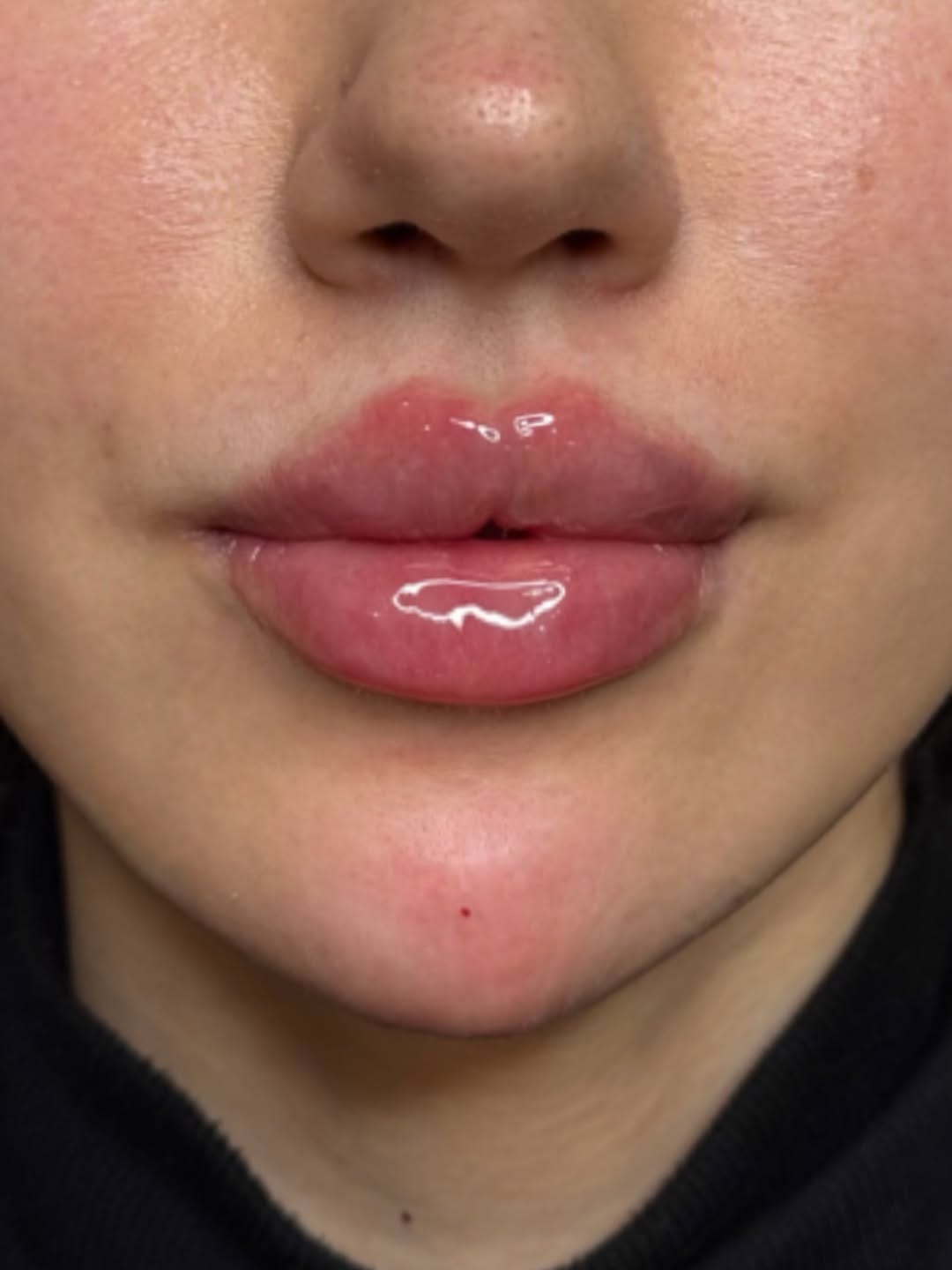 Post 3 by 𝐉𝐨𝐝𝐢𝐞 𝐏𝐚𝐫𝐬𝐨𝐧𝐬 l 𝐃𝐨𝐥𝐥𝐬𝐟𝐚𝐜𝐞 𝐀𝐞𝐬𝐭𝐡𝐞𝐭𝐢𝐜𝐬 ® l 𝐂𝐥𝐢𝐧𝐢𝐜 & 𝐀𝐜𝐚𝐝𝐞𝐦𝐲 on Instagram (image)