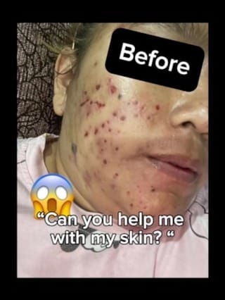 Post 9 by Love Your Skin,Love Your Self on Instagram (video)
