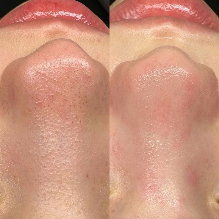 Post 2 by Love Your Skin,Love Your Self on Instagram (image)