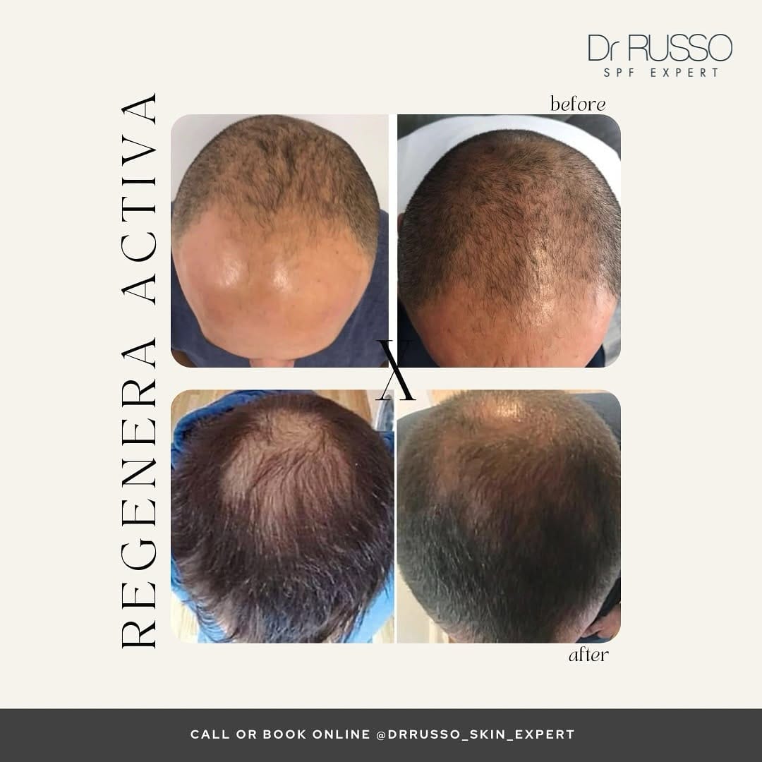 Post 10 by Dr Mario Luca Russo, MD, MS on Instagram (image)