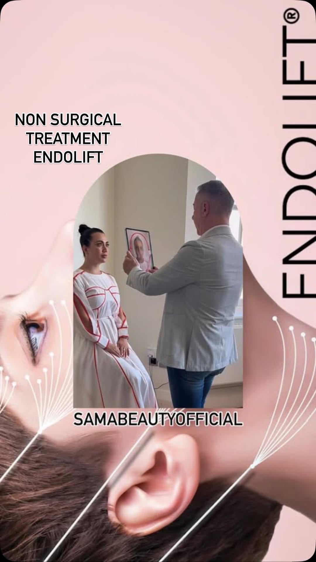 Post 9 by Dr Mario Luca Russo, MD, MS on Instagram (video)