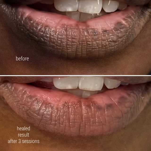 Post 6 by Kate Dark | Lip Blush & Camouflage London on Instagram (video)