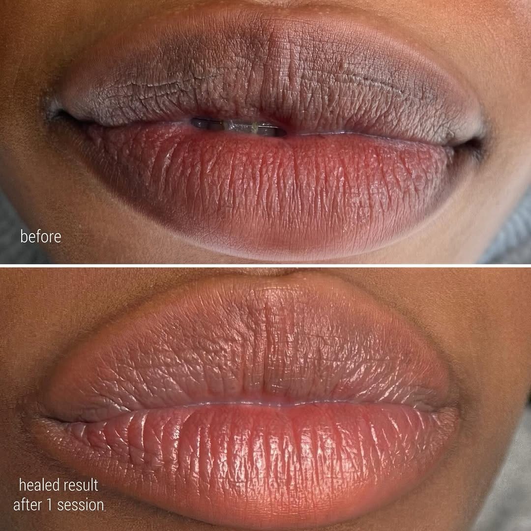 Post 3 by Kate Dark | Lip Blush & Camouflage London on Instagram (image)