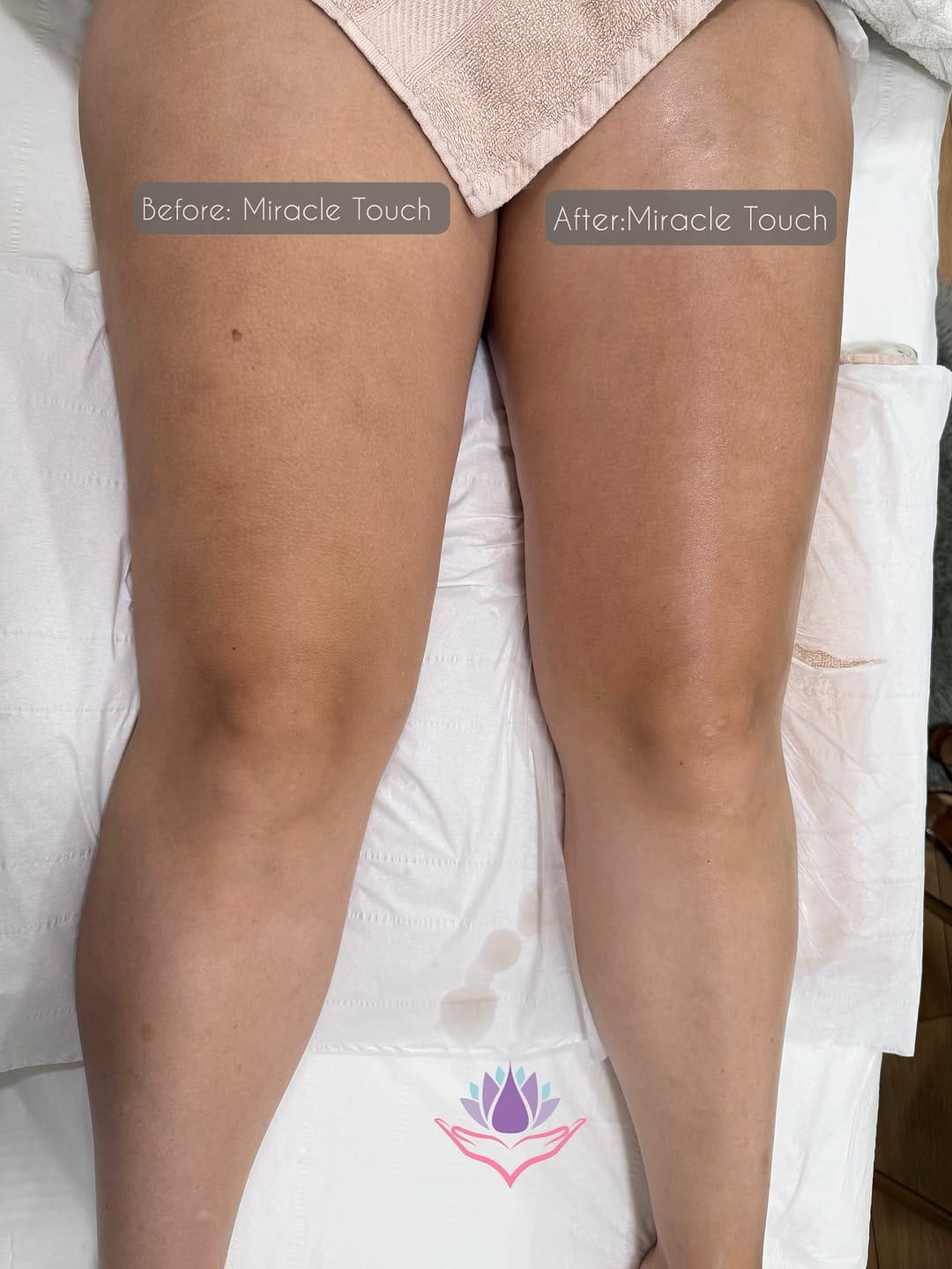 Post 6 by Essences Day Spa & Aesthetic Clinic on Instagram (image)