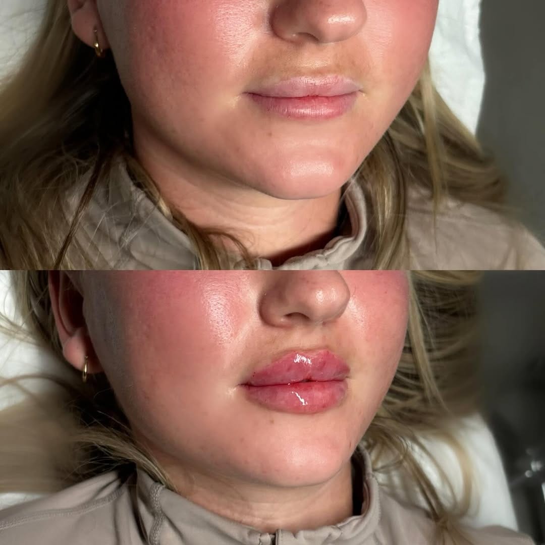 Post 2 by JCLINICS (jessica cooke) on Instagram (image)