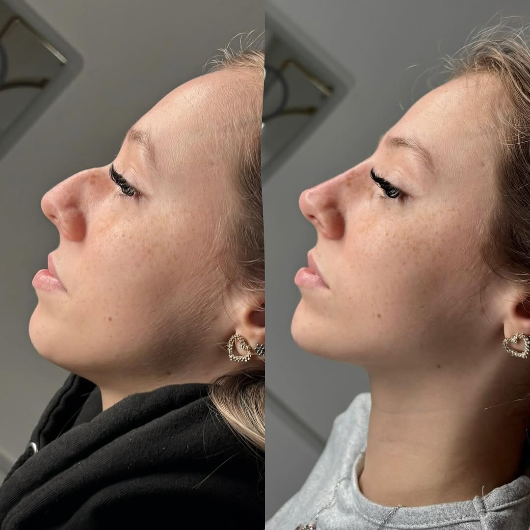Post 9 by JCLINICS (jessica cooke) on Instagram (carousel)