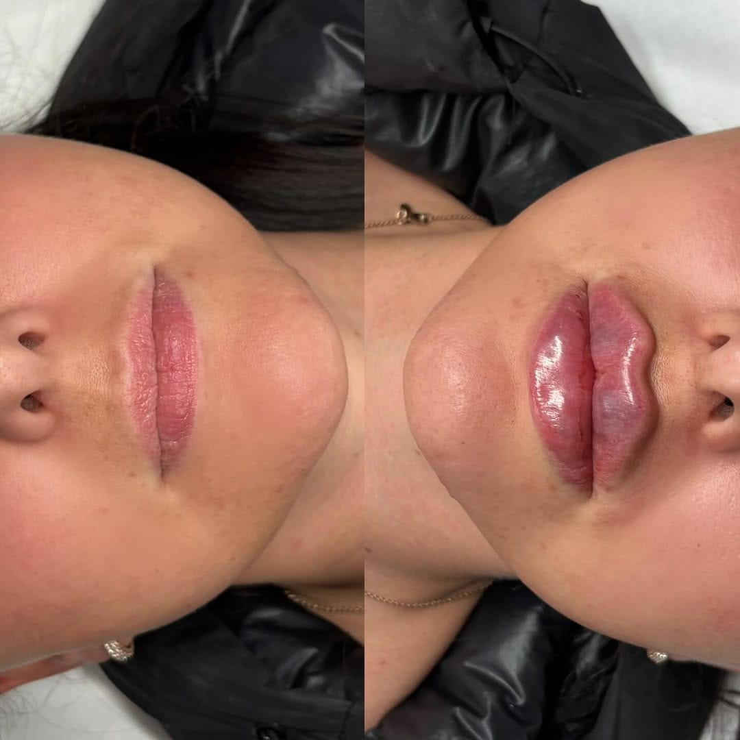 Post 8 by JCLINICS (jessica cooke) on Instagram (image)