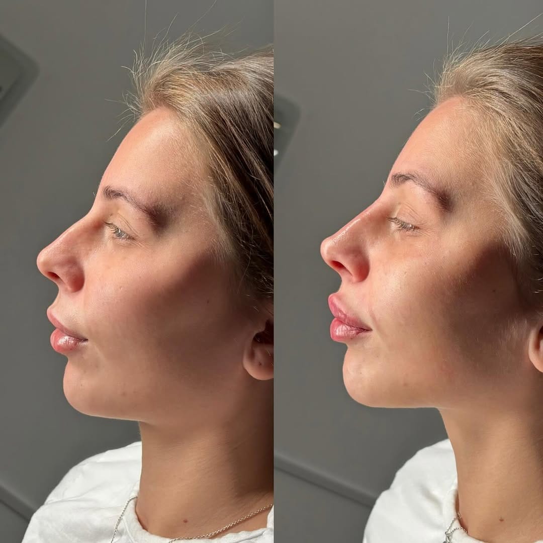 Post 6 by JCLINICS (jessica cooke) on Instagram (carousel)