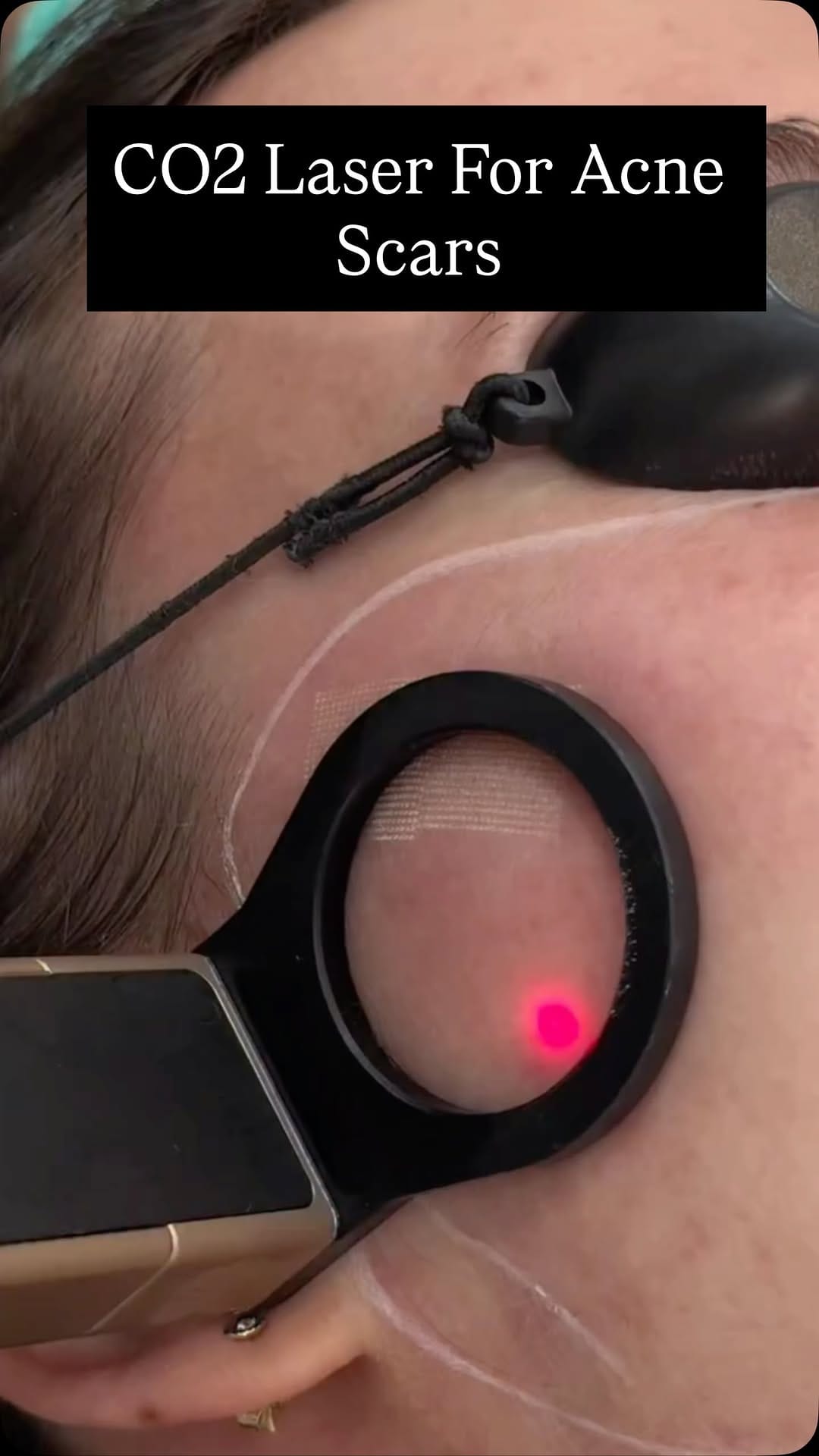 Post 1 by DrMediSpa Winner Best Clinic Group UK on Instagram (video)