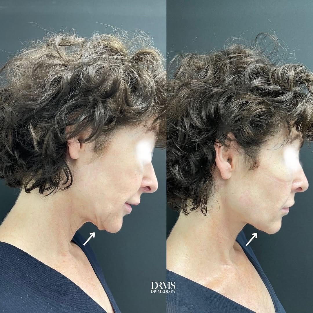 Post 2 by DrMediSpa Winner Best Clinic Group UK on Instagram (image)