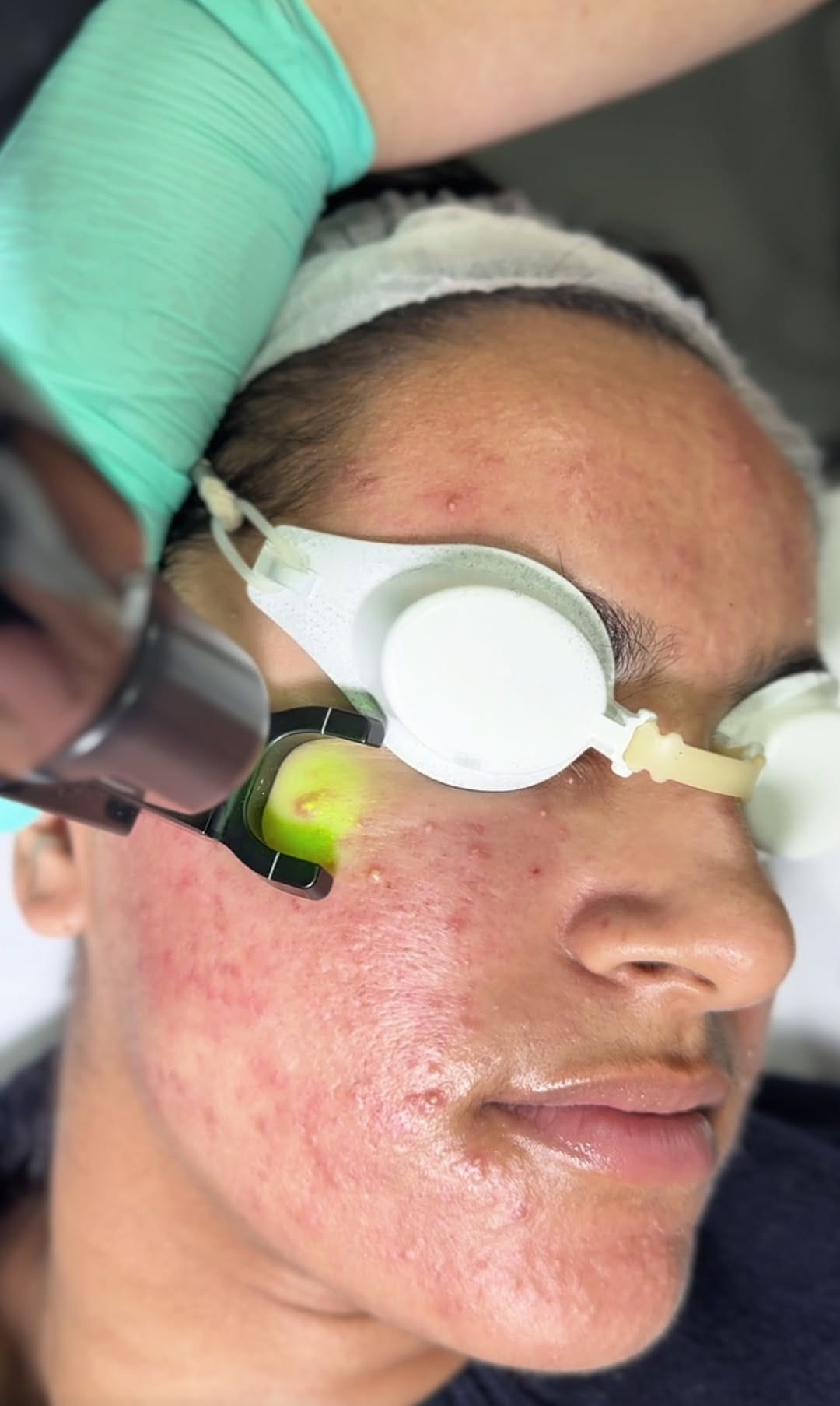 Post 6 by DrMediSpa Winner Best Clinic Group UK on Instagram (video)