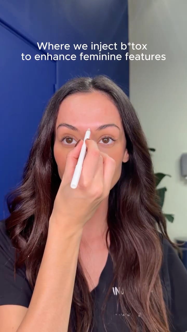 Post 8 by Injectual Injectables: #1 Polynucleotides, Profhilo & Filler on Instagram (video)