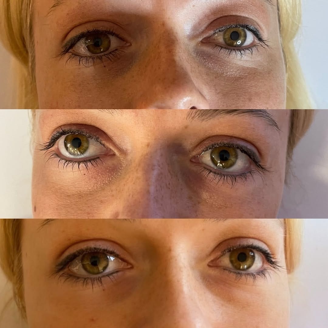 Post 5 by SLIMLINES AESTHETICS. Regenerative + Aesthetic Medicine on Instagram (image)