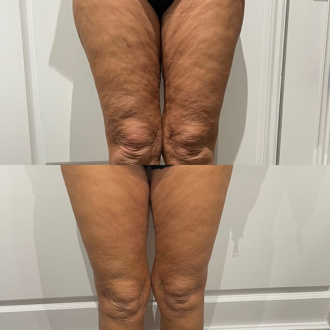 Post 7 by SLIMLINES AESTHETICS. Regenerative + Aesthetic Medicine on Instagram (image)