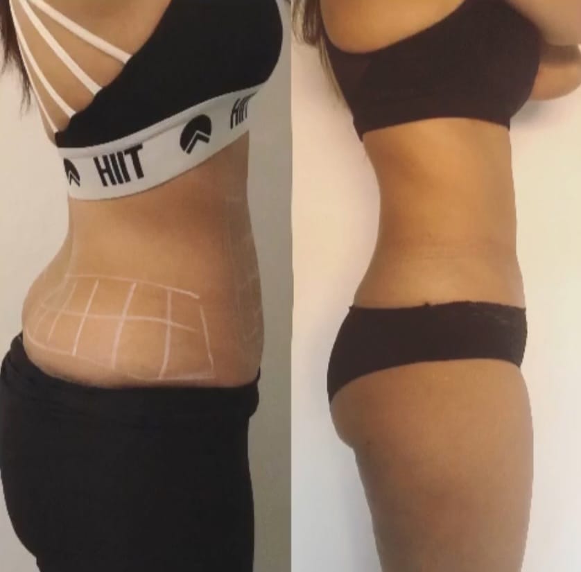 Post 10 by SLIMLINES AESTHETICS. Regenerative + Aesthetic Medicine on Instagram (image)