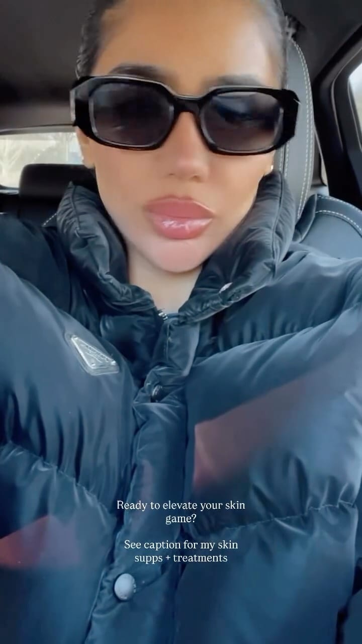 Post 9 by SLIMLINES AESTHETICS. Regenerative + Aesthetic Medicine on Instagram (video)