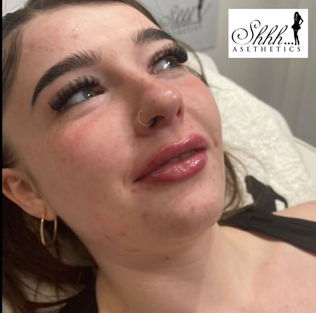 Post 7 by SKIN BOOSTERS | ANTI AGING on Instagram (image)